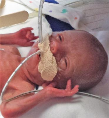 571fa606cb16b4a37d5ad336